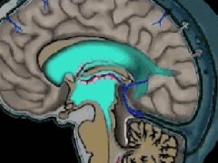 健康科普 | 脑子真的会进水吗？带您一起了解什么是脑积水