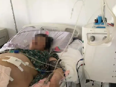 灌注新疗法——抗癌新利器