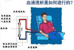 守护血透患者的“生命线”——我们一直在行动