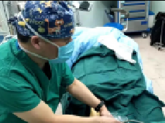 精准麻醉 保障患者安全舒适度过围手术期